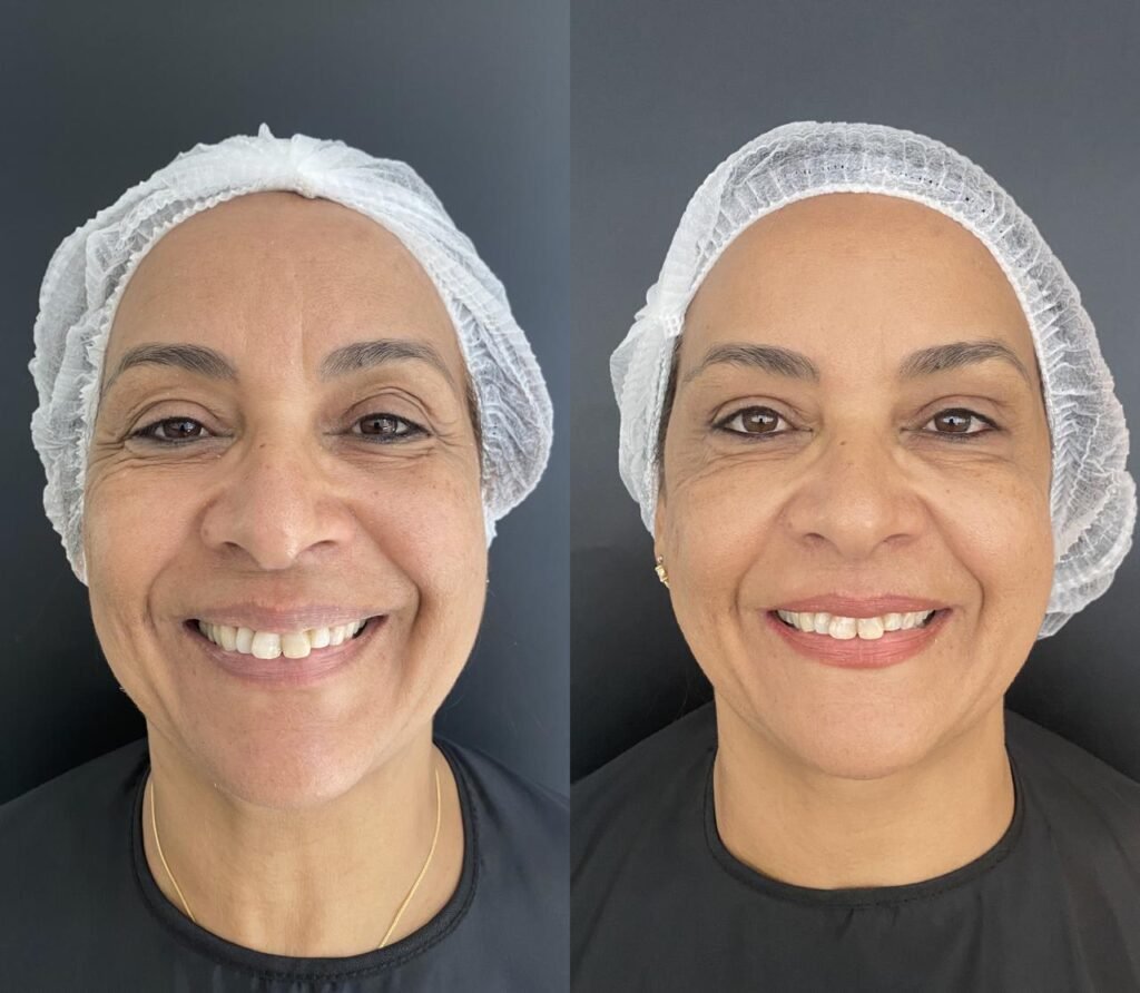 Antes e depois da paciente